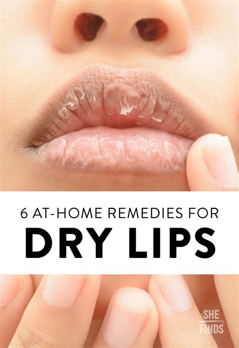 The Science Behind Therapist's Magical Lip Remedy Gel